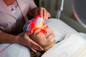 ipl intense pulse light